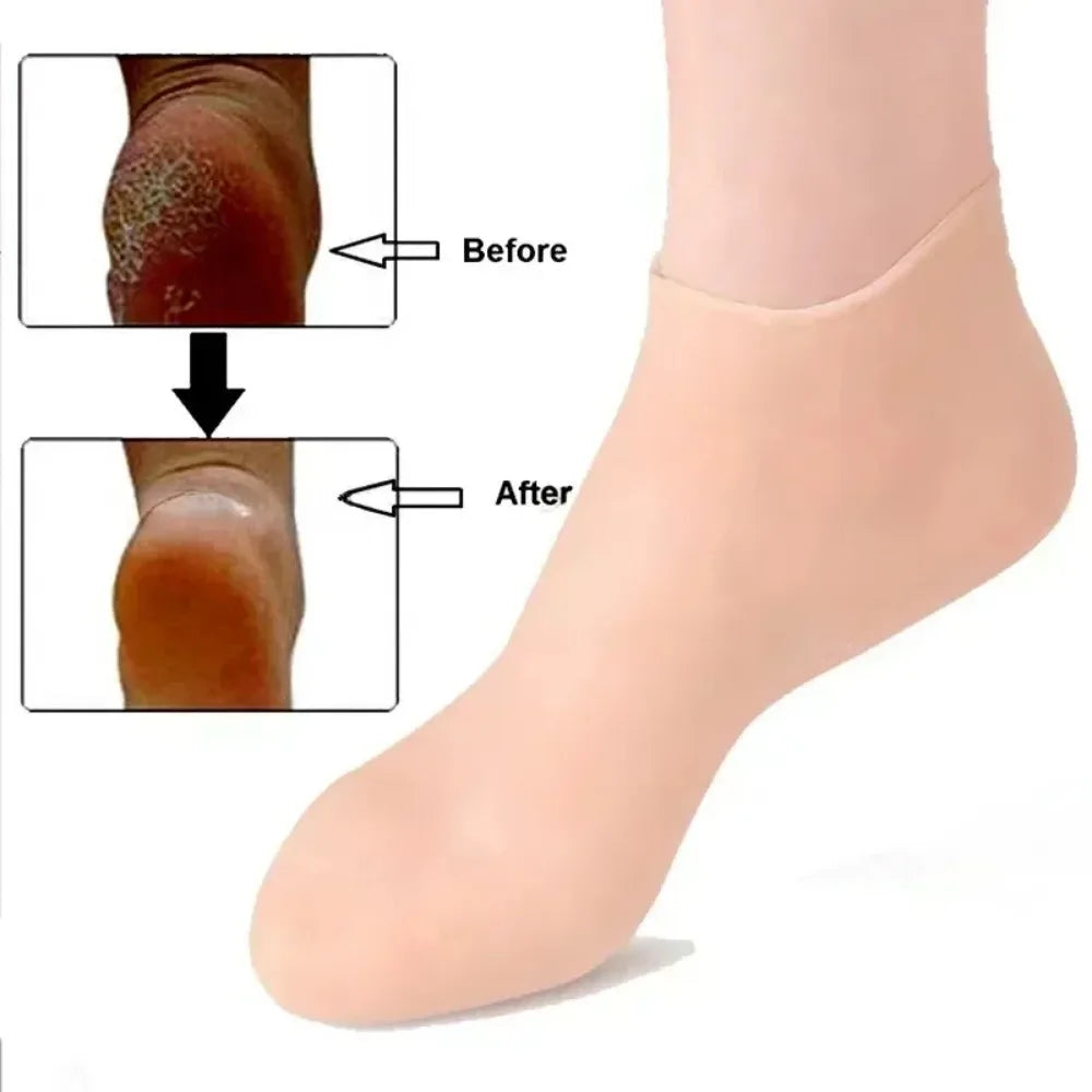 SpaSox™: Silicone Moisturizing Gel Socks - Exfoliate, Hydrate, and Protect Against Dry, Cracked Skin